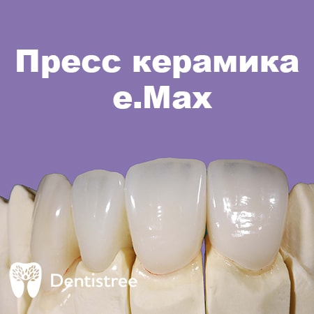 Пресс керамика е.Max